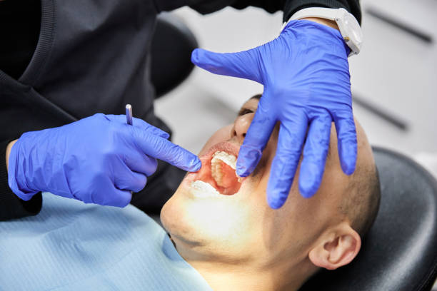 Best Emergency Dental Care for Broken or Chipped Teeth in Bodfish, CA
